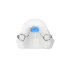 Orthodontic Appliance