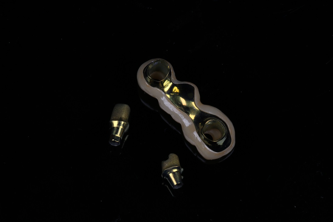 How to Solve a Critical Case with Insufficient Occlusal Space?