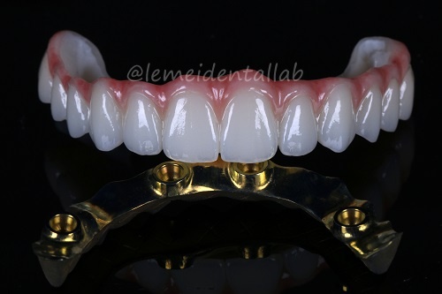 1764994198677406.jpg Ti bar Integrated with Zirconia Bridge_副本.jpg